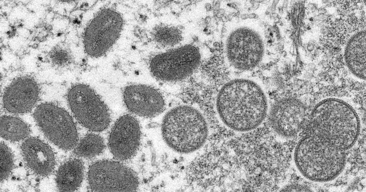 Un premier cas de variole du singe détecté dans le canton de Berne