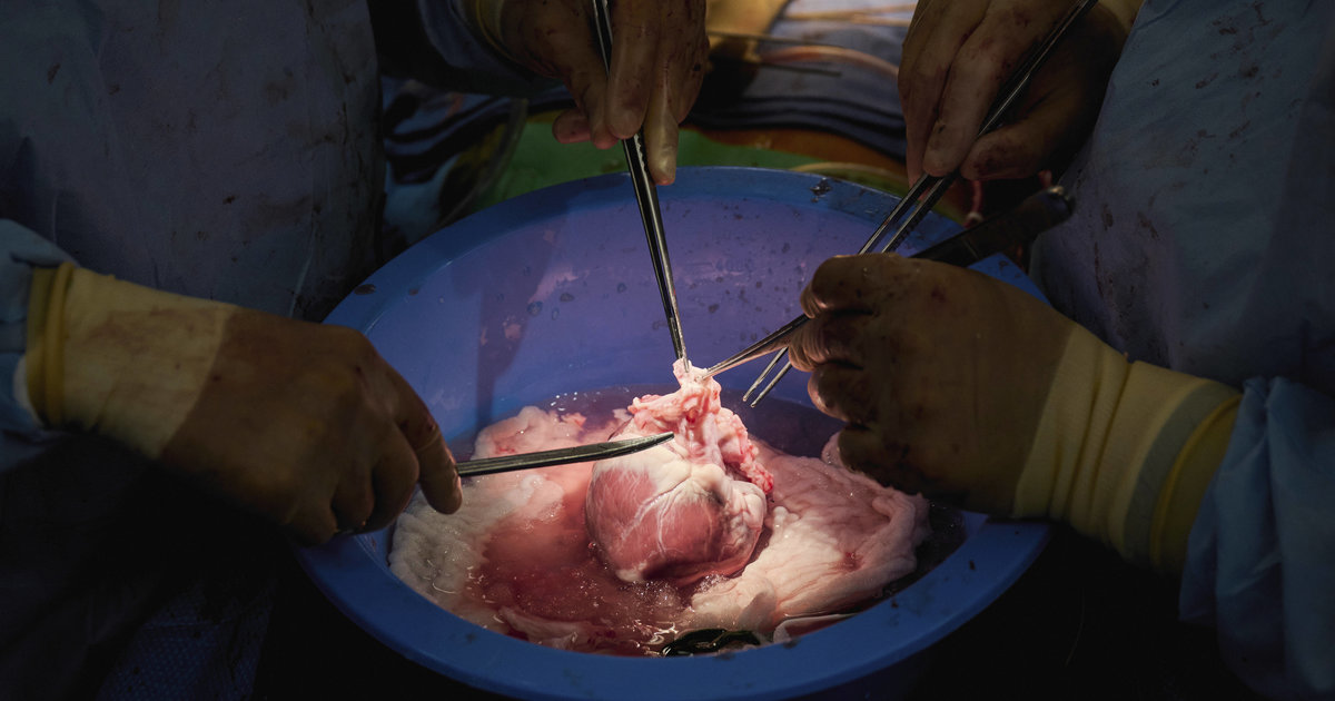 In New York, two pig heart transplant trials in deceased patients