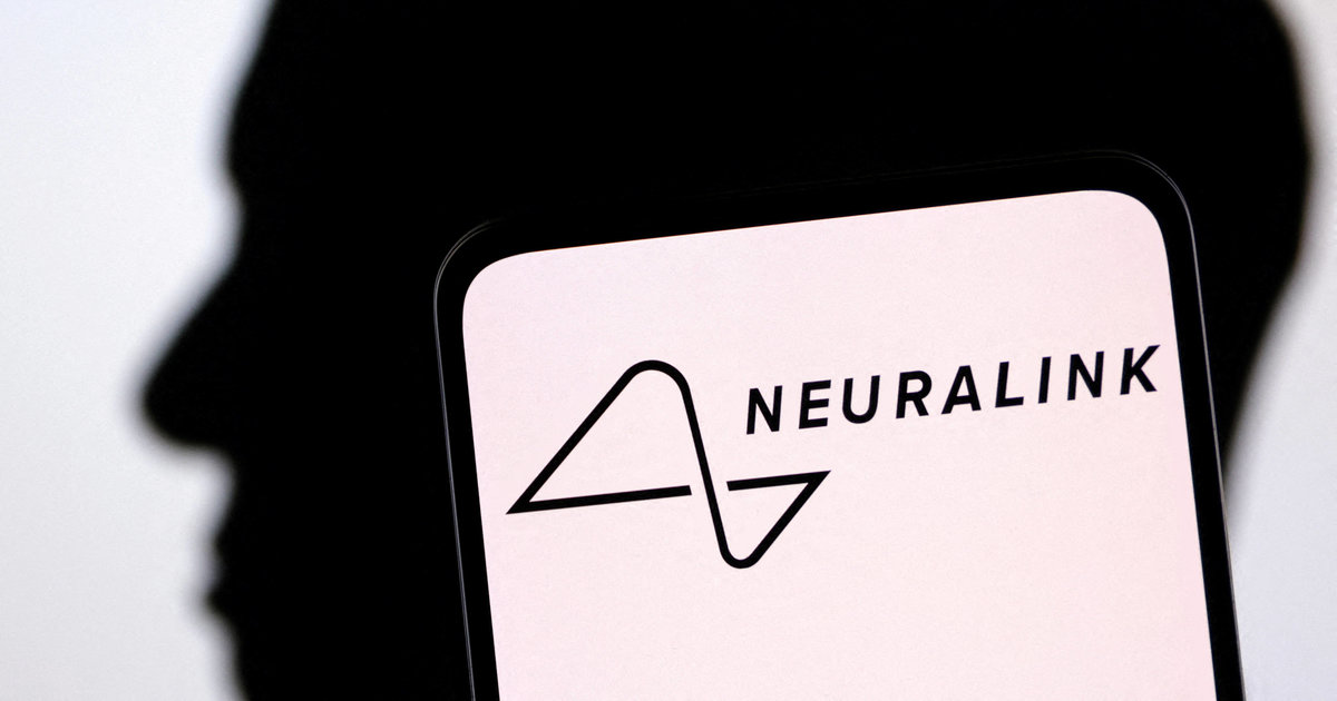 Les autorités sanitaires américaines autorisent Neuralink à tester ses implants cérébraux sur des humains
